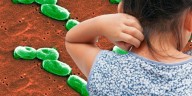Ralstonia pickettii, la bacteria que infectó a 12 niños en el INSN de San Borja: qué es, síntomas y por qué puede llegar a ser mortal