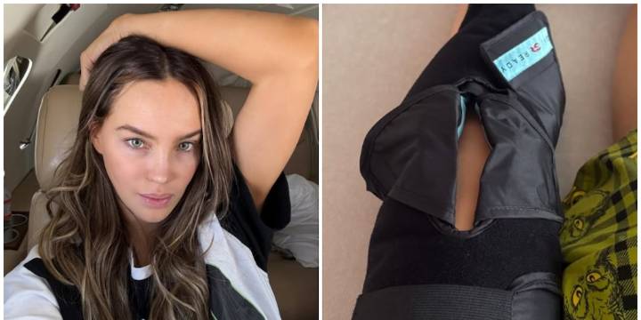 Belinda sufre aparatosa lesión: esto se sabe sobre su estado de salud y su participación en ‘Mentiras El Musical’