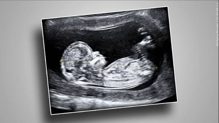 Texas has a new abortion pill law. But at least one provider plans to keep shipping them there