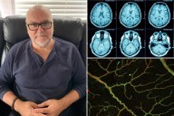 Australian man Patrick Dare's HR meeting reveals frontal lobe dementia diagnosis