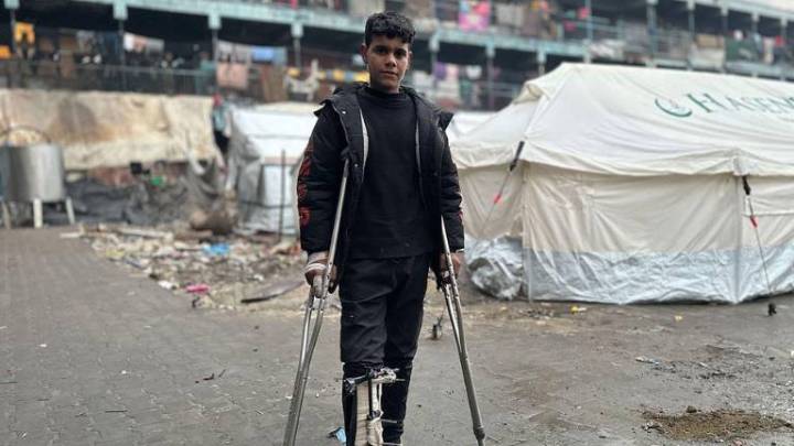 Decenas de miles de niños han quedado discapacitados en los casi dos años de guerra en Gaza