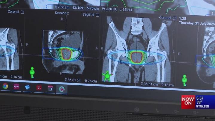 New technology helps pinpoint and personalize radiation for cancer patients