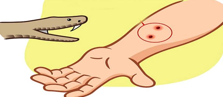Woman, daughter die of snakebite in Odisha’s Keonjhar