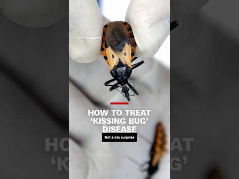 How to diagnosis and treat ‘kissing bug’ disease