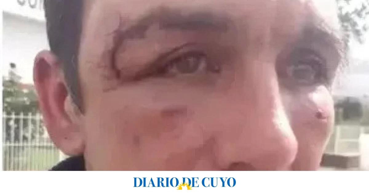 Arranca el juicio a 3 policías por golpear a un hombre ebrio que paró para no chocar