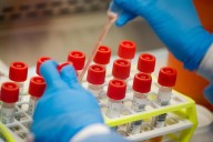 EPA scientist at Duluth lab says he was fired after signing ‘Declaration of Dissent’