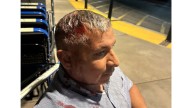 Man shot in head with ‘less lethal’ projectile at Santa Ana protest wants $50 million from OC