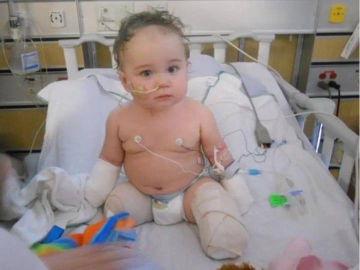 Alberta quadruple amputee teen gets landmark $17