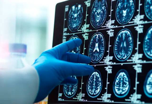 Hombre que mató a tiros a cuatro personas en Nueva York en julio tenía trastorno cerebral