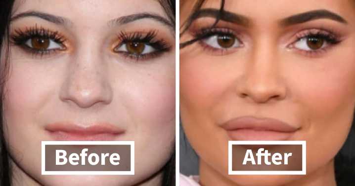 This Instagram Account Posts Side-By-Side Photos Of Celebs To Show How Much They’ve Changed Through The Years (30 Pics)