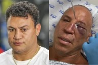Acelino Freitas Faces Lawsuit Threat From Wanderlei Silva After “Cowardly Attack” Leaves Ex