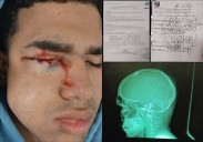 Exigen justicia para joven herido de bala en Caracas por un vecino
