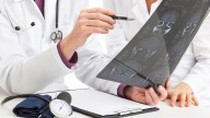 Faltan recursos para gestionar el aumento de casos de alzheimer