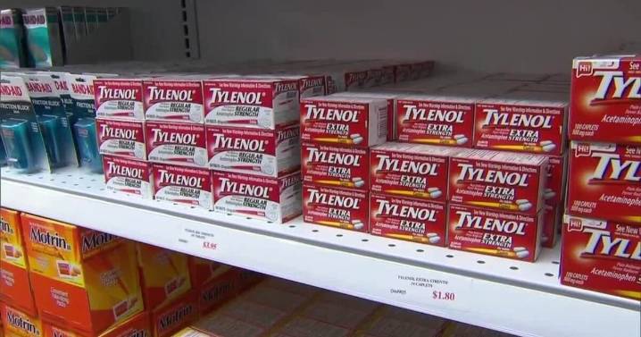 ‘Not as black and white’: Doctors urge caution as Trump admin links Tylenol use in pregnancy to autism spike
