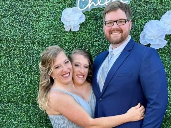 Las siamesas más famosas del mundo, Abby y Brittany Hensel, se mostraron con un bebé en una foto viral y causaron sorpresa