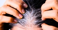 Lo mejor para las canas: para qué sirve aplicar vinagre de manzana y cómo hacerlo de manera correcta