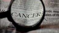 Living Well Through Cancer Care: Expert Tips To Manage Side Effects Of Treatment