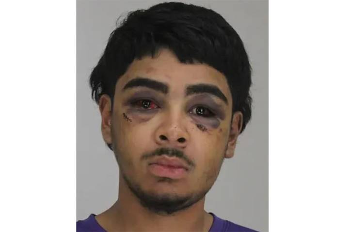 Battered and Bloodied Teen Fatally Shot a Father at His Son’s Baptism. Now He’s Claiming Self
