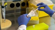 Nace el primer test en sangre que permite adelantarse al alzhéimer