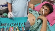 29 Steel Spoons, 19 Toothbrushes, and 2 Pens Removed from Stomach of a Man: Video goes Viral