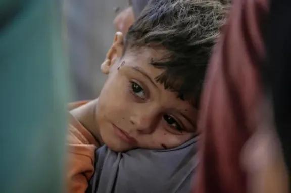 Al menos 21.000 niños quedaron discapacitados en Gaza desde el inicio de la guerra