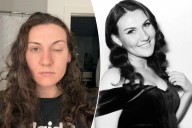 I can’t open my eye after really bad botched Botox