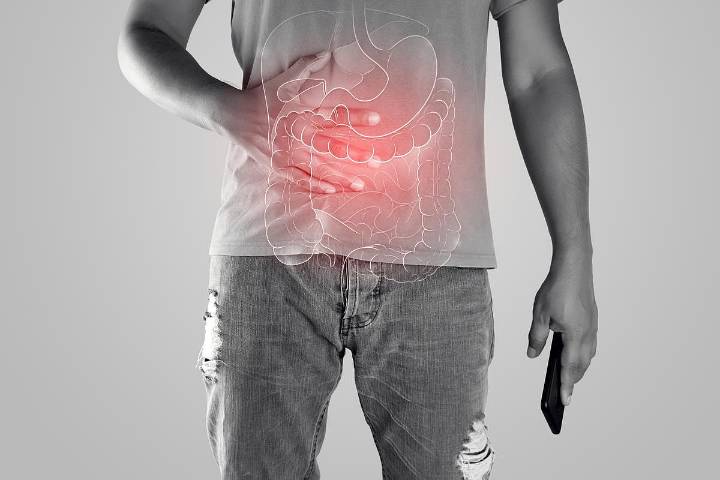 FDA Approves Subcutaneous Tremfya Induction Treatment for Ulcerative Colitis