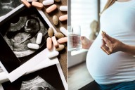 Pregnant women pop Tylenol 'like Tic Tacs' after Trump’s autism claim