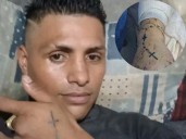 Familias de Erick y Alfonso pasan horas entre la vida y esperanza