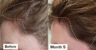 Struggling With Hair Loss, Thinning, Or Not Much Volume? We've Found The Solution