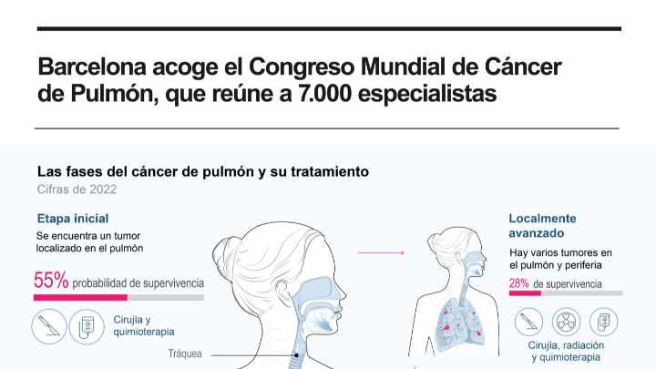 [Infografía] Barcelona acoge el Congreso Mundial de Cáncer de Pulmón