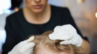 Cómo adelantarse a los piojos en la vuelta al cole: prevención y cuidados
