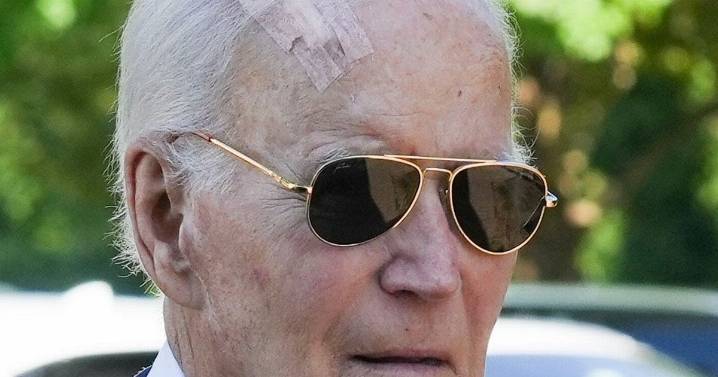 Ex-US President Joe Biden has cancer surgery as he's pictured with wound on his head