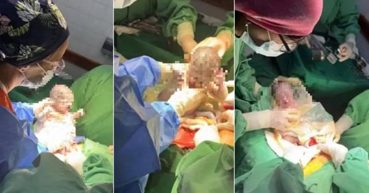 Ainara, Amira y Ámbar: las trigemelas que sorprendieron en un parto que ocurre cada millón
