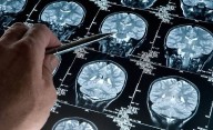 Científicos argentinos hicieron un nuevo hallazgo sobre el Alzheimer
