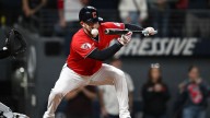 Guardians' David Fry carted off after 99 mph pitch hits face