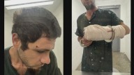 Inmate says jailers broke his arm; sheriff disputes with video evidence