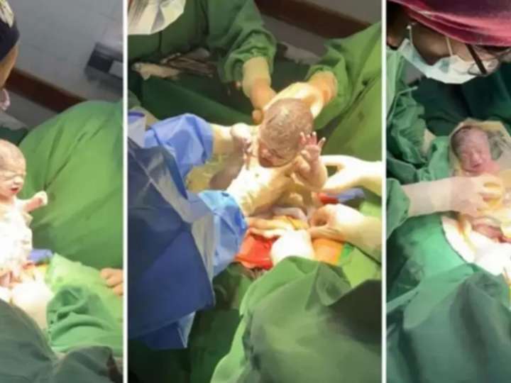 Nacieron trigemelas en Salta, un extraño fenómeno que se produce cada un millón de embarazos
