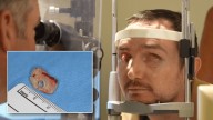 De un Ibuprofeno a la Ceguera: Historia de un Implantación Sorprendente que Devolvió la Vista a un Hombre
