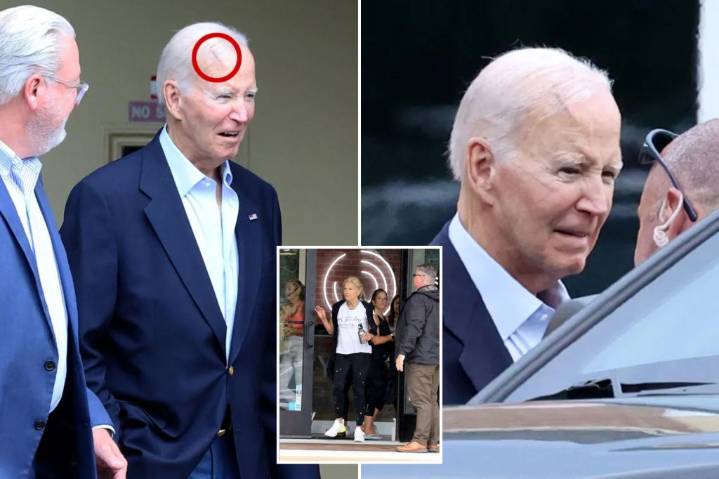 Joe Biden, 82, spotted leaving church with gash on his head after getting skin cancer removed