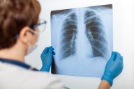 ¿Qué es la silicosis y cómo afecta a los trabajadores en Atacama?