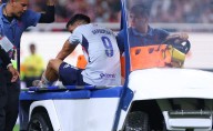 Cruz Azul revela gravedad de la lesión de Ángel Sepúlveda