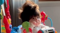 People call this baby a ‘real-life Cabbage Patch doll'