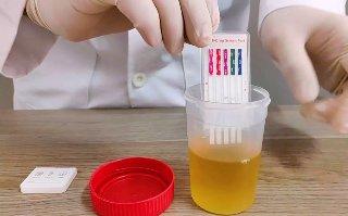 Propuesta de antidoping obligatorio para toda la clase política en Jalisco causa furor
