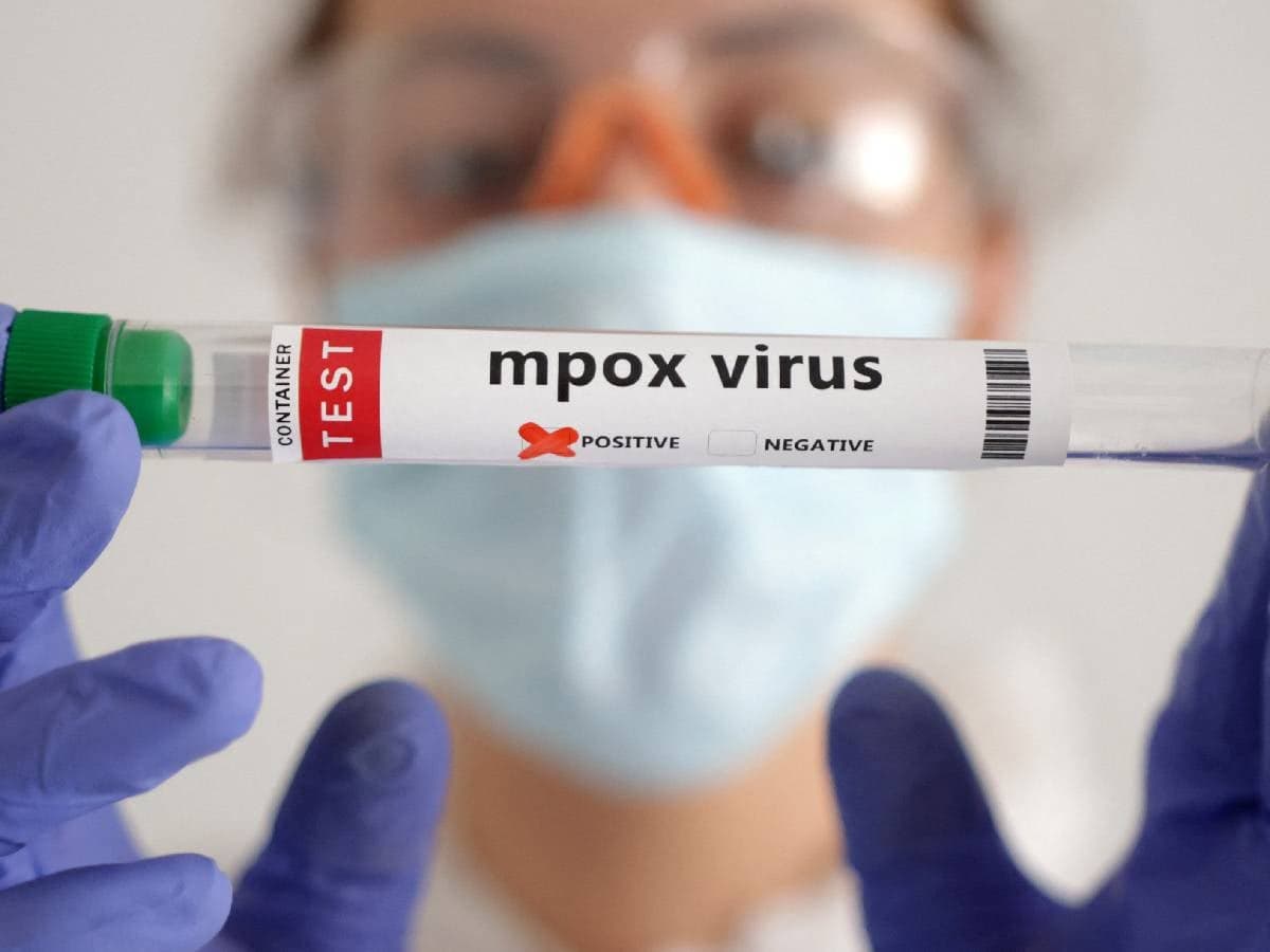 Mpox deja de ser emergencia sanitaria internacional, confirma la OMS