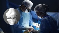 Científicos crean dispositivo "3D" que promete revolucionar las cirugías ortopédicas