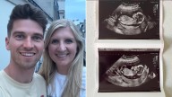 I’m A Celebrity’s Rebecca Adlington announces ‘miracle’ pregnancy after miscarriage heartache