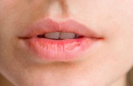Un nuevo antiviral contra el herpes simple doblega la resistencia a los tratamientos