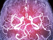 Las emociones refuerzan la memoria: un hallazgo revela cómo el cerebro decide qué recordar