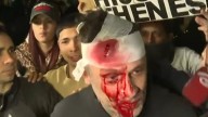Incidentes en el acto de Milei en Moreno: le revolearon un botellazo a un periodista